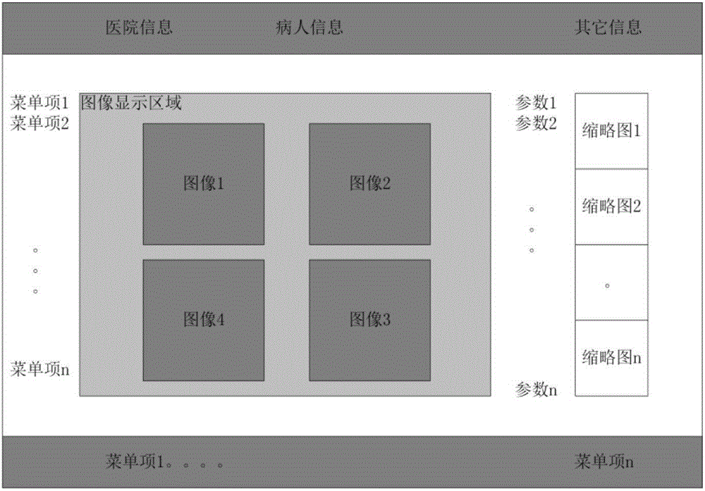 Ultrasonic system and multi-image imaging method thereof