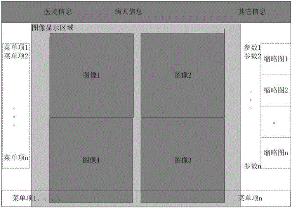 Ultrasonic system and multi-image imaging method thereof