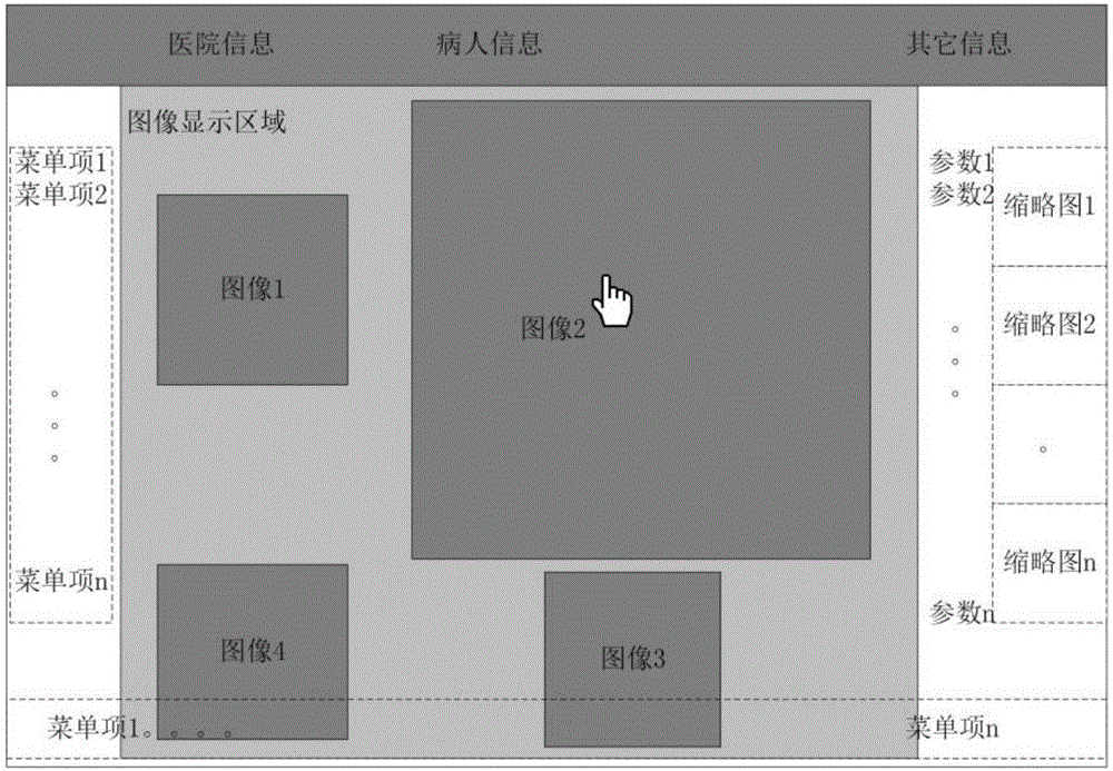 Ultrasonic system and multi-image imaging method thereof