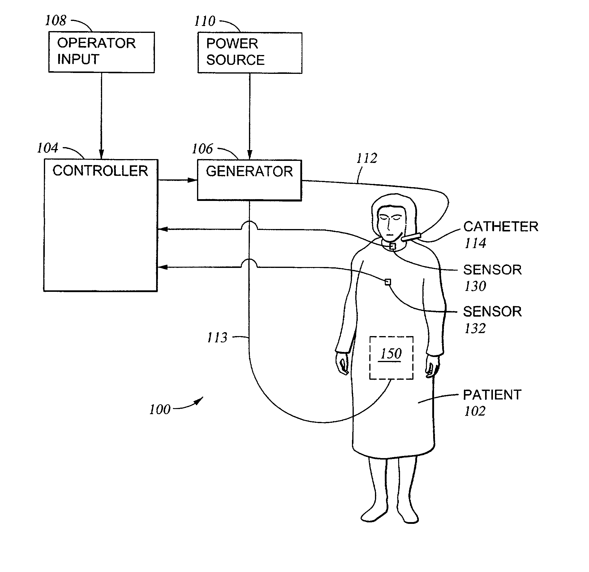 System and method employing indwelling RF catheter for systemic patient warming by application of dielectric heating