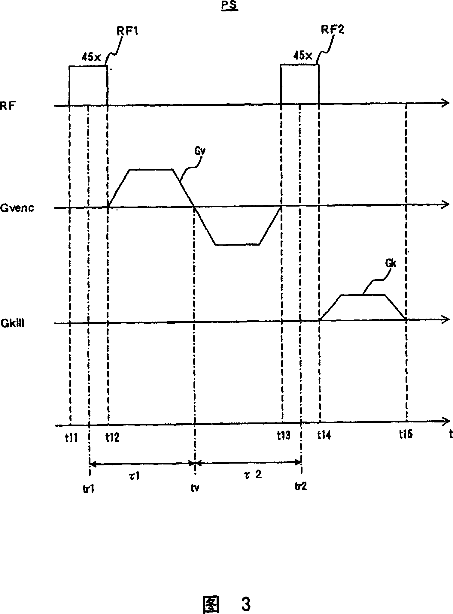 Magnetic resonance imaging apparatus