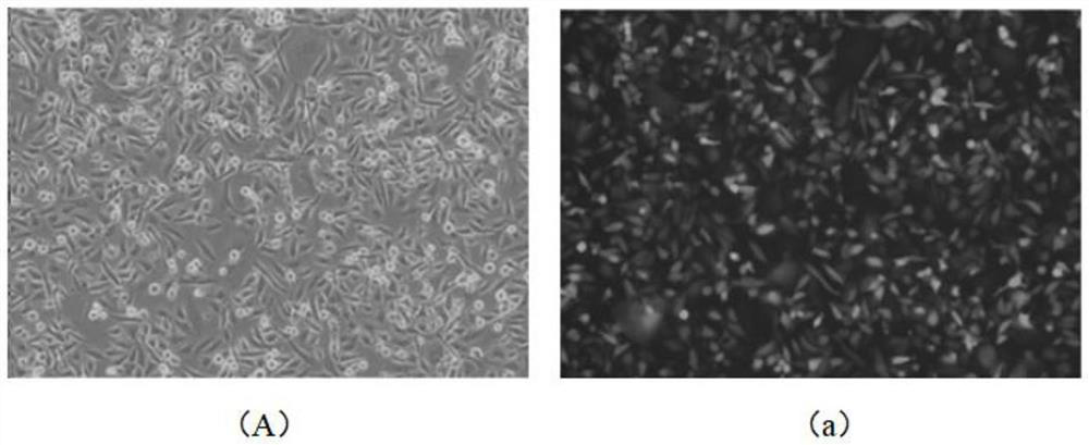 Infection enhancing culture medium and method for improving cell lentivirus infection rate