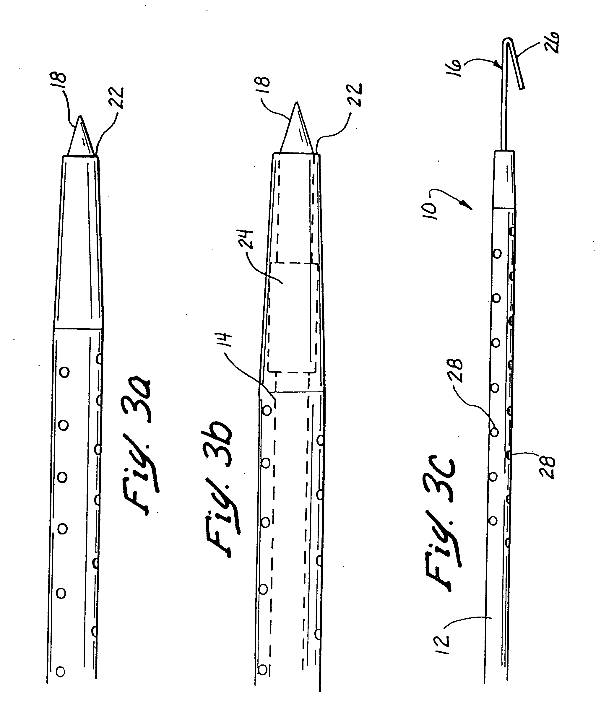 Methods and apparatus for securing medical instruments to desired locations in a patient's body