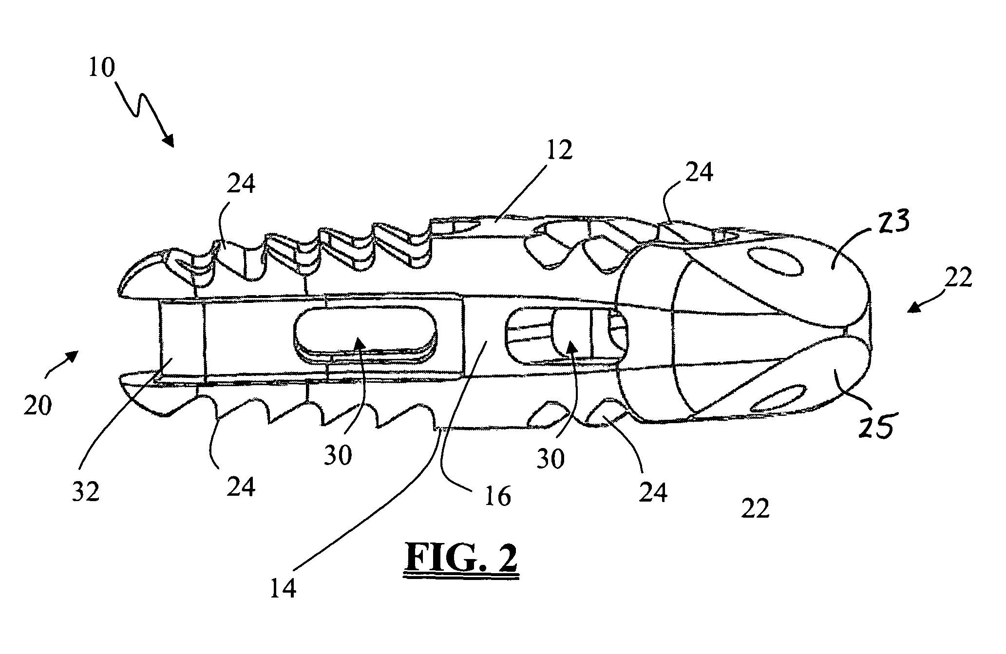 Spinal fusion implant and related methods