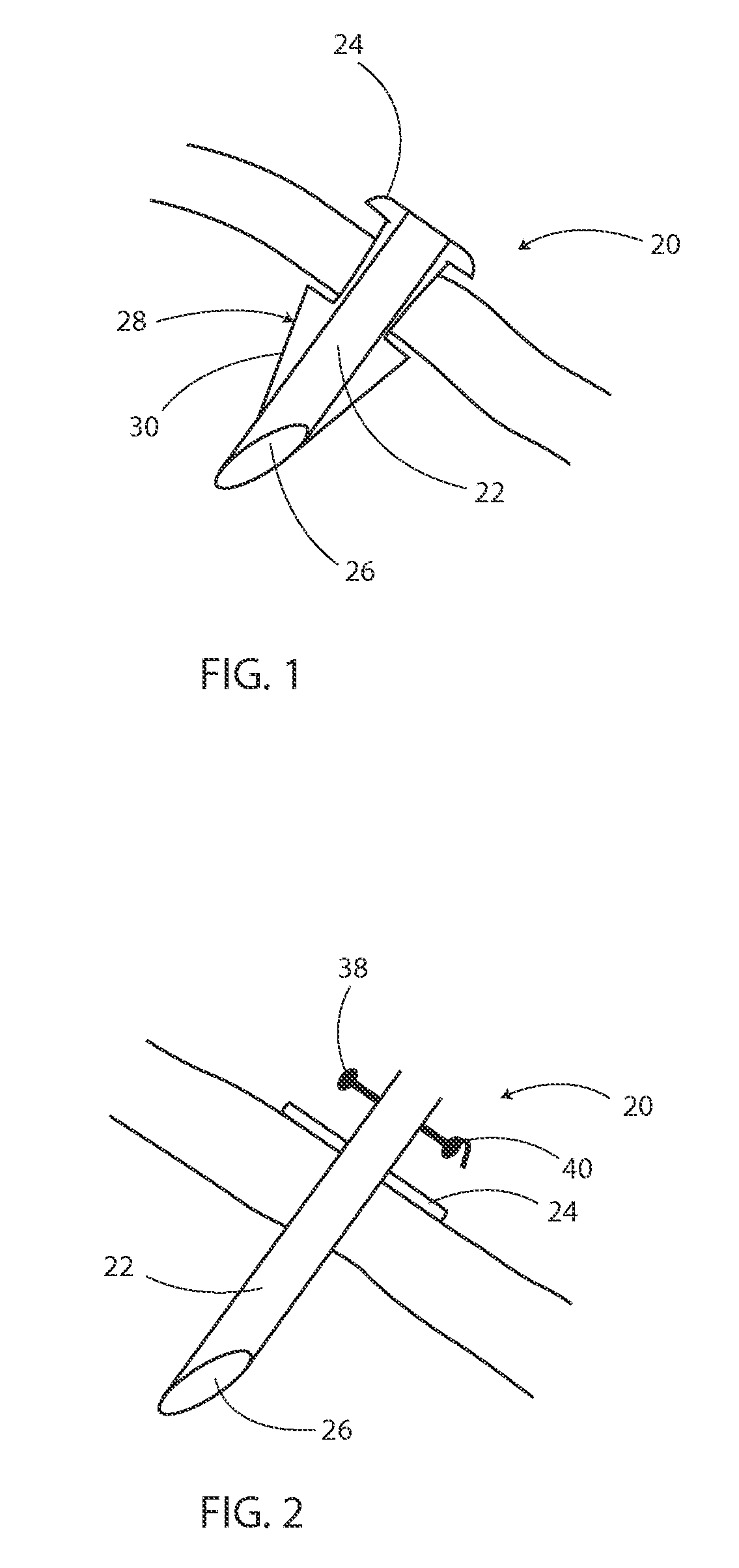 Surgical tools and methods for their use