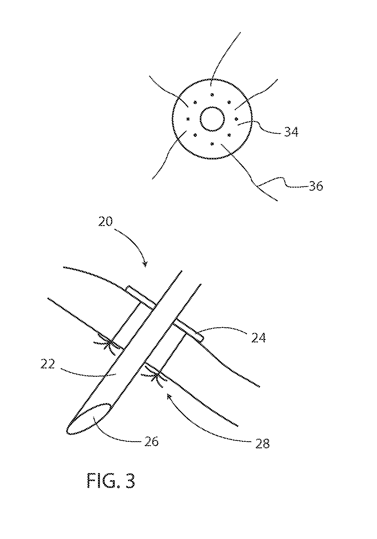 Surgical tools and methods for their use