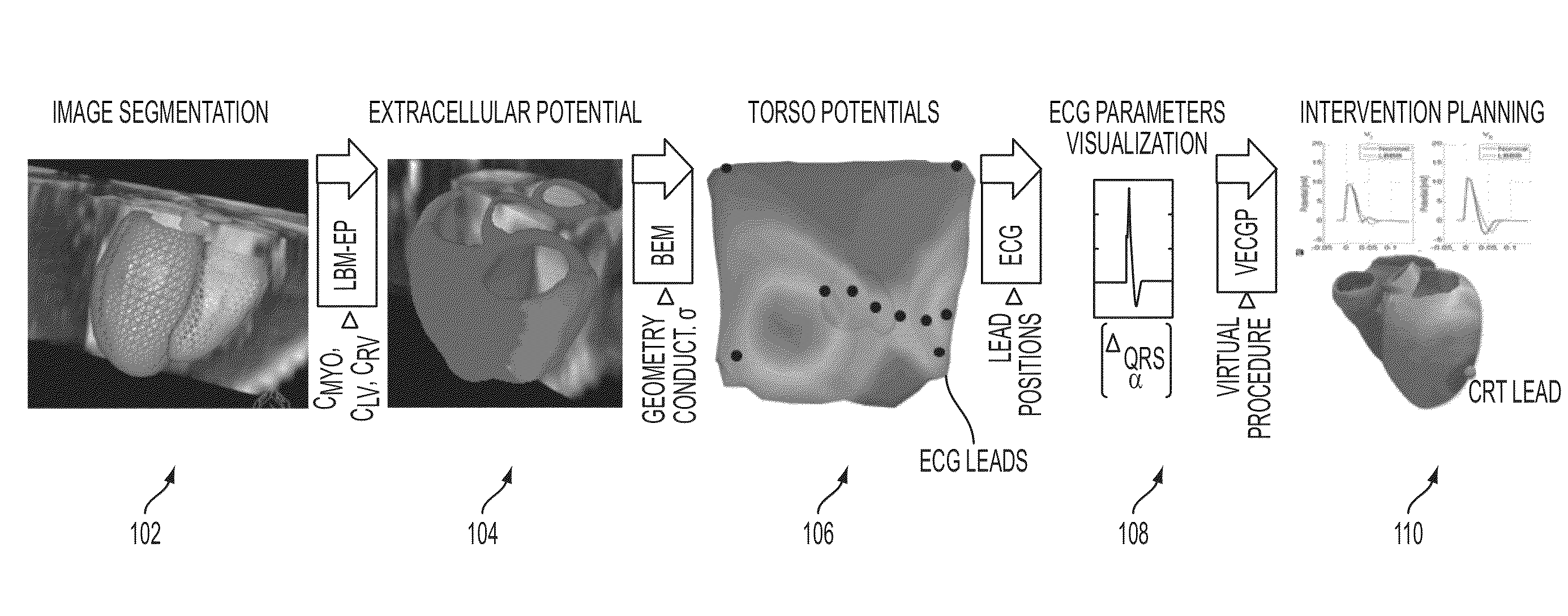 System and Method for Patient Specific Planning and Guidance of Electrophysiology Interventions