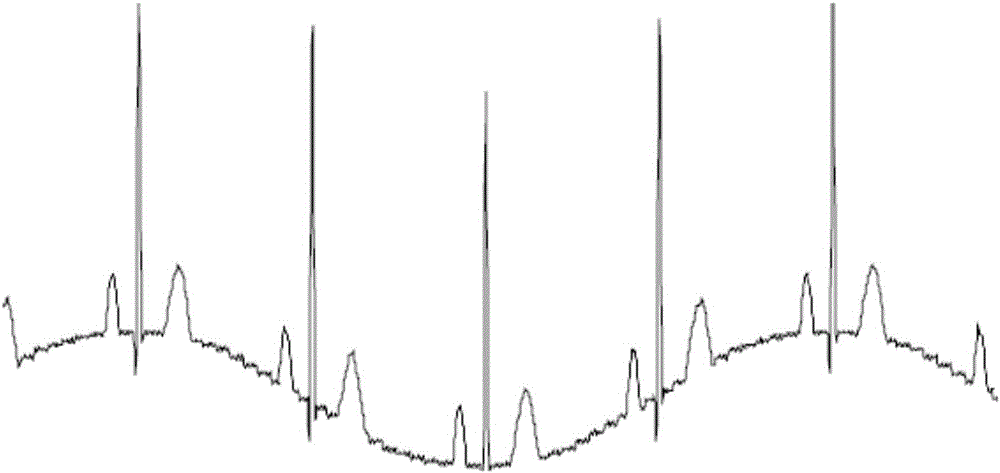 Method and device for extracting respiratory signal