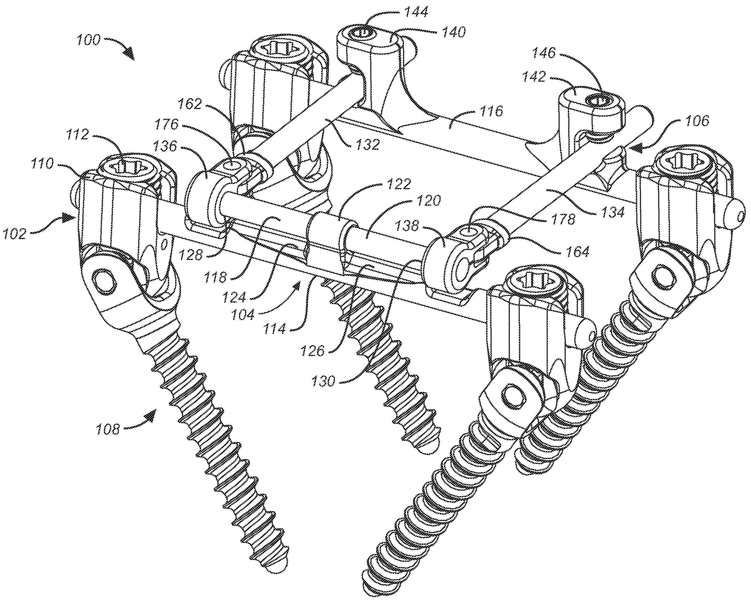 Revision system for a dynamic stabilization and motion preservation spinal implantation system and method