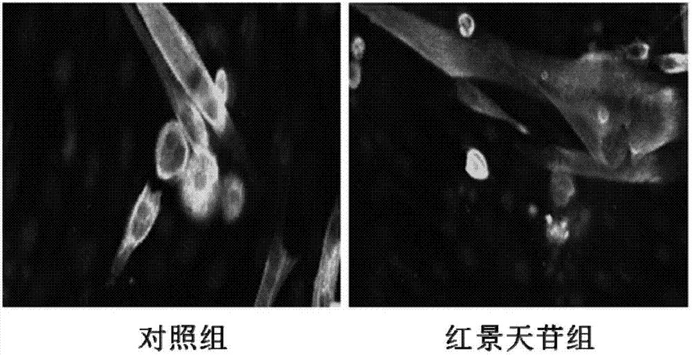 Application of salidroside in preventing and treating amyotrophy diseases