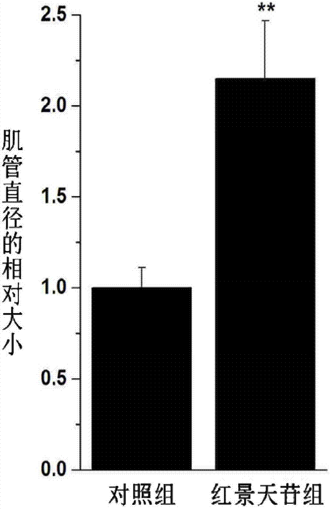 Application of salidroside in preventing and treating amyotrophy diseases