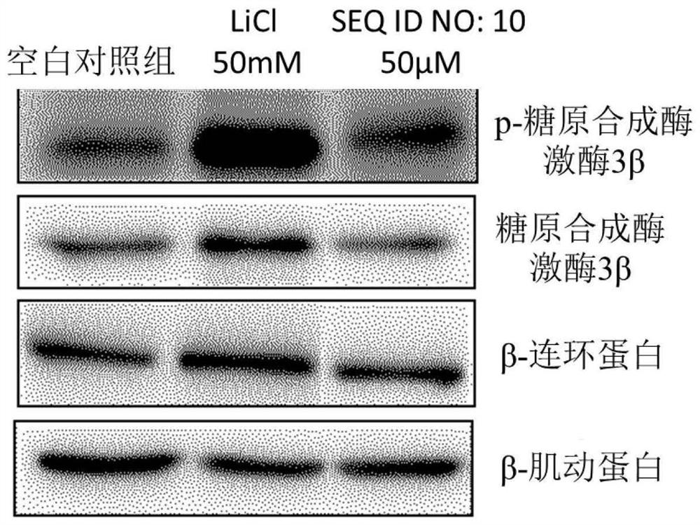 Peptide for reducing hair loss and promoting hair growth, and cosmetic composition and pharmaceutical composition comprising same