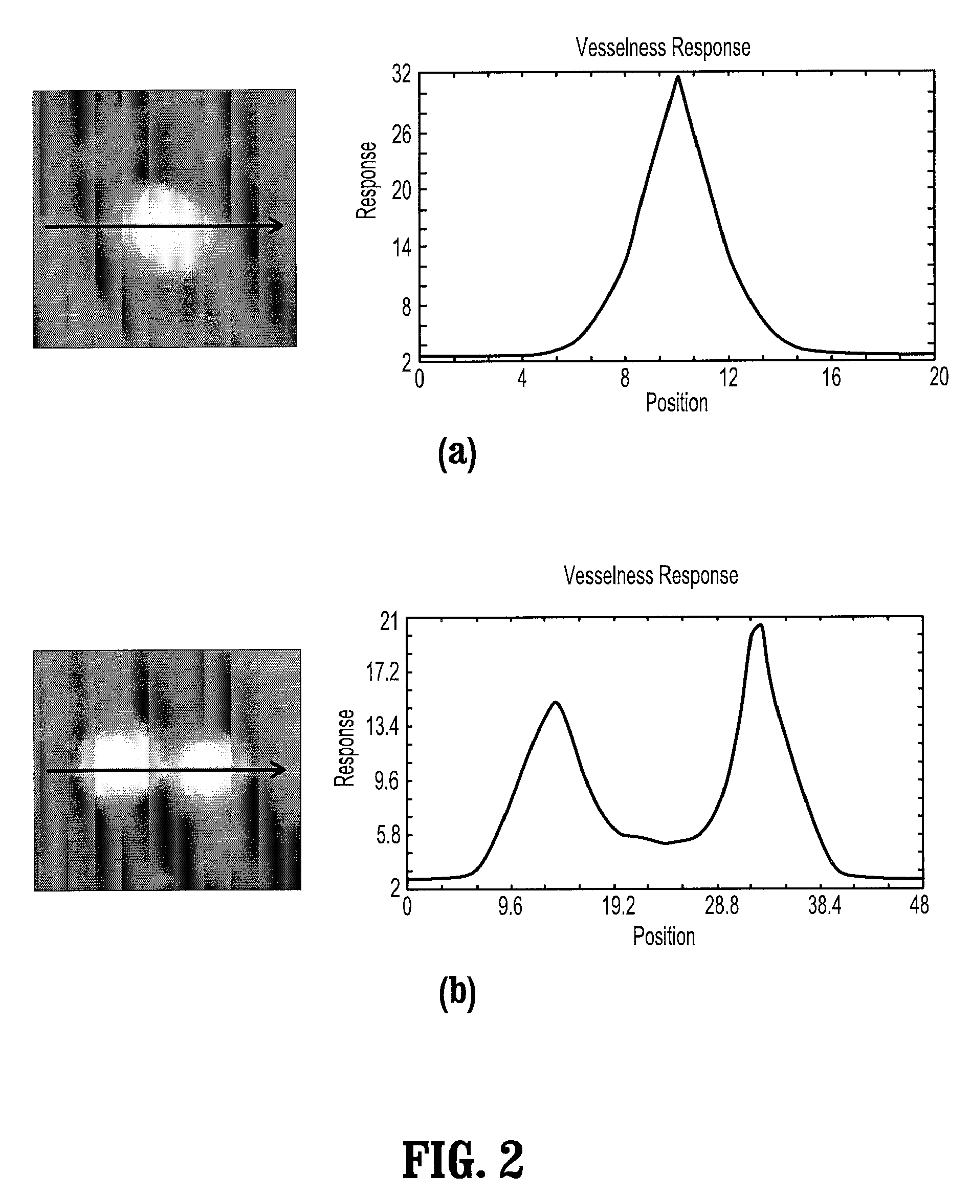 Robust Vessel Tree Modeling