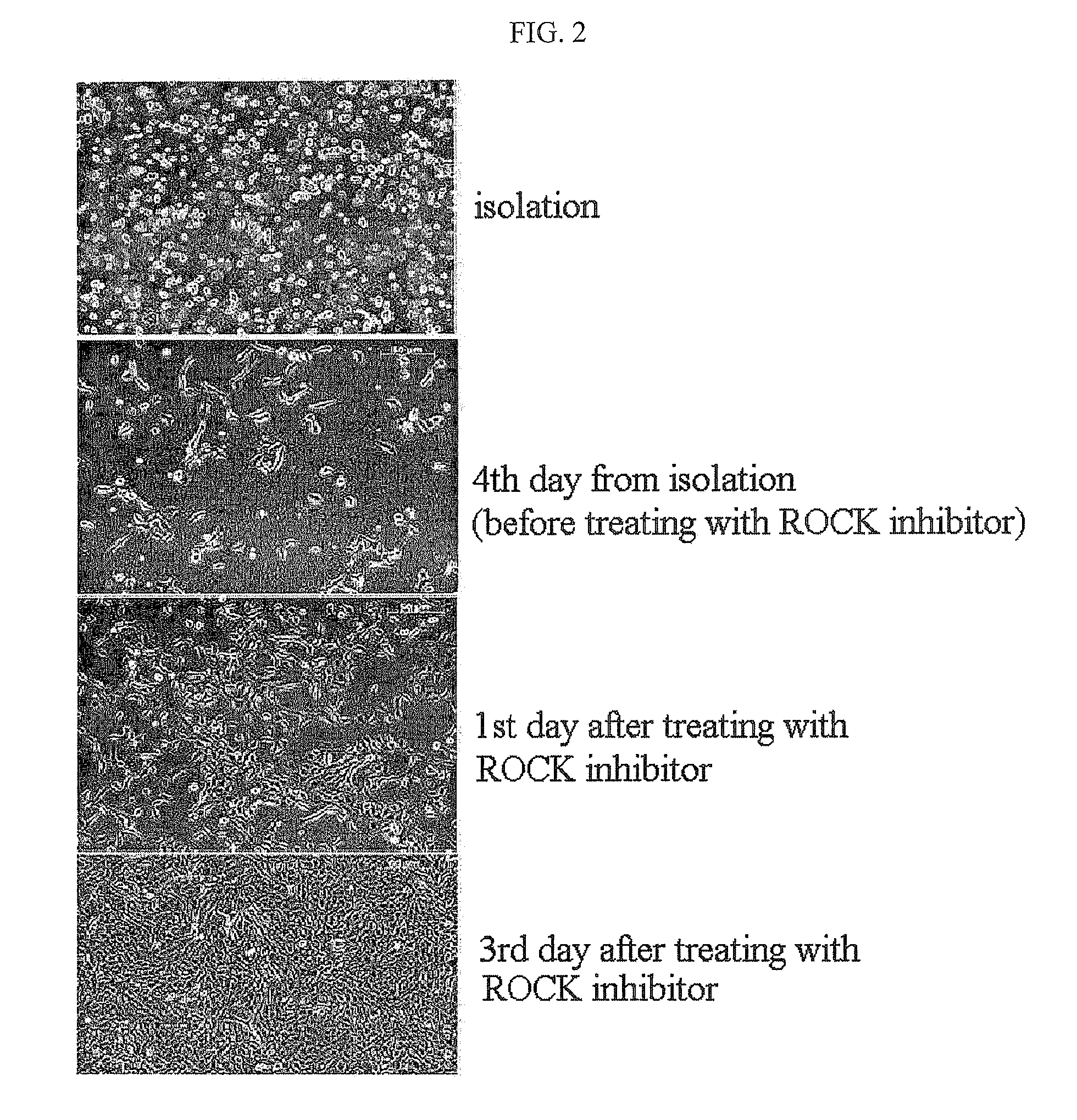 Method for isolating and culturing adult stem cells derived from human amniotic epithelium