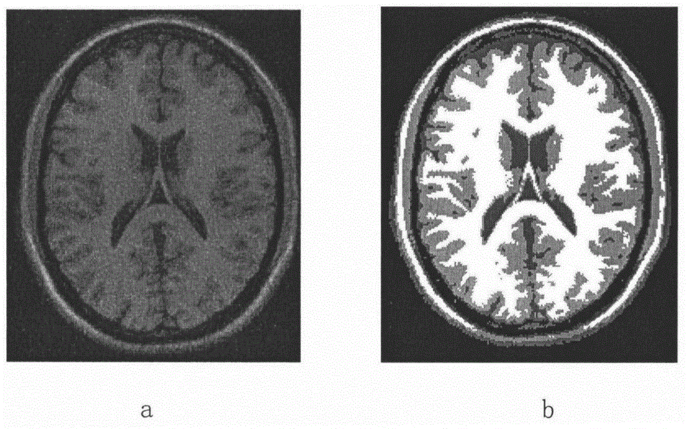 Medical image segmentation method