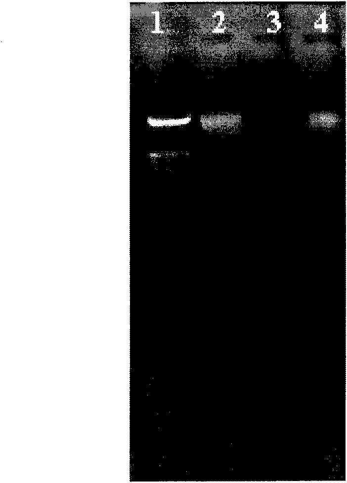 Virulent phage sensitive to riemerella anatipestifer and application thereof