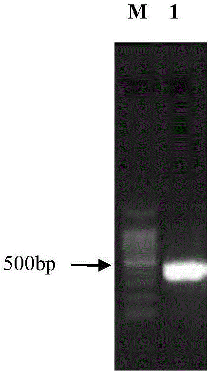 ELISA (Enzyme Linked Immunosorbent Assay) kit for detecting fowl adenovirus antibody based on hexon protein N-terminal conservative area