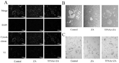 Medicine for preventing medicine-related osteonecrosis of jaw