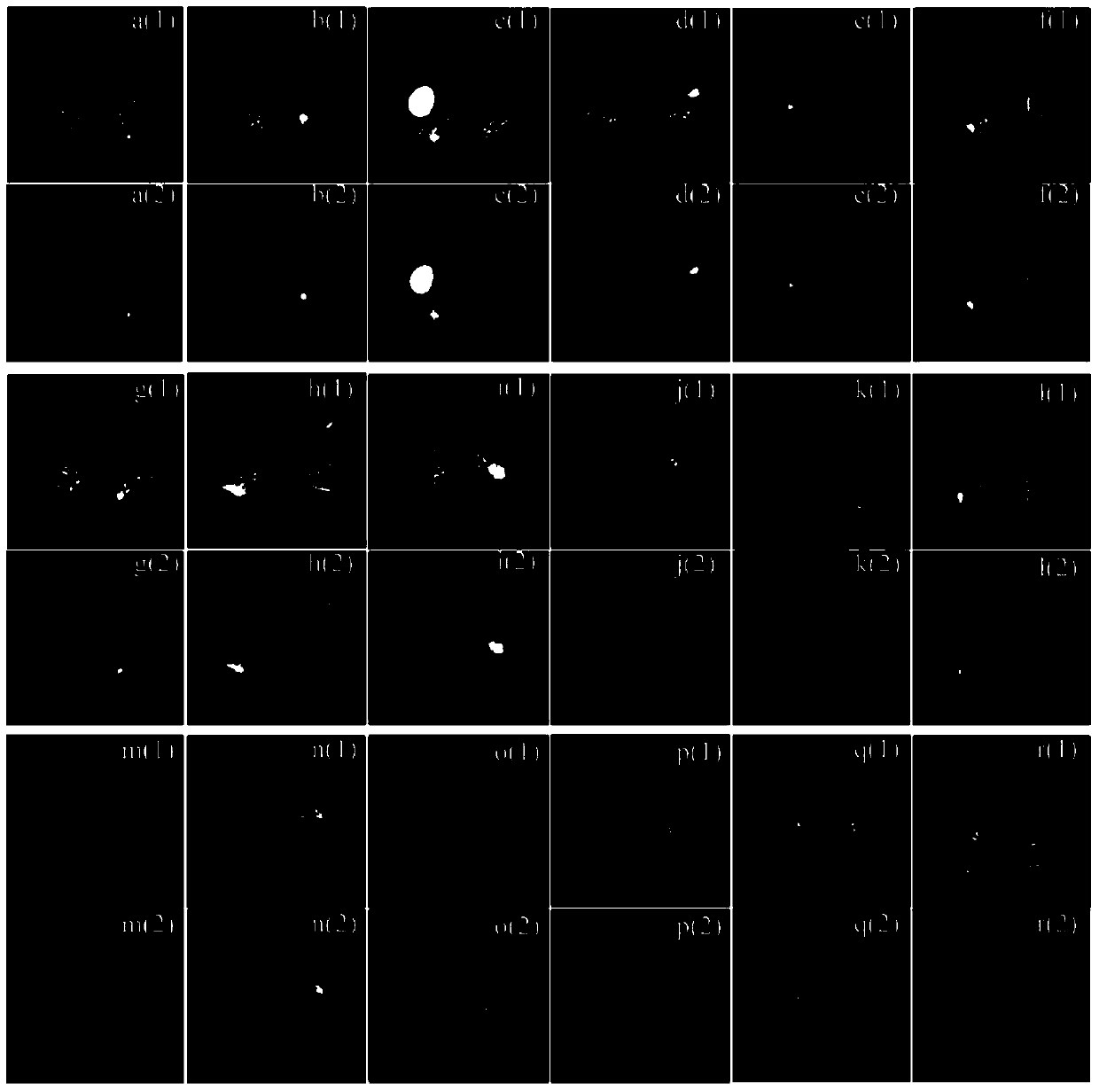 Automatic Segmentation Method of Abnormal Areas in Lung CT Images