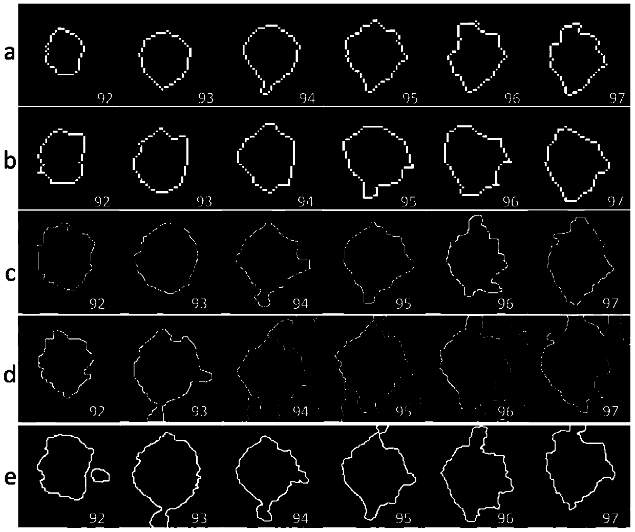 Automatic Segmentation Method of Abnormal Areas in Lung CT Images