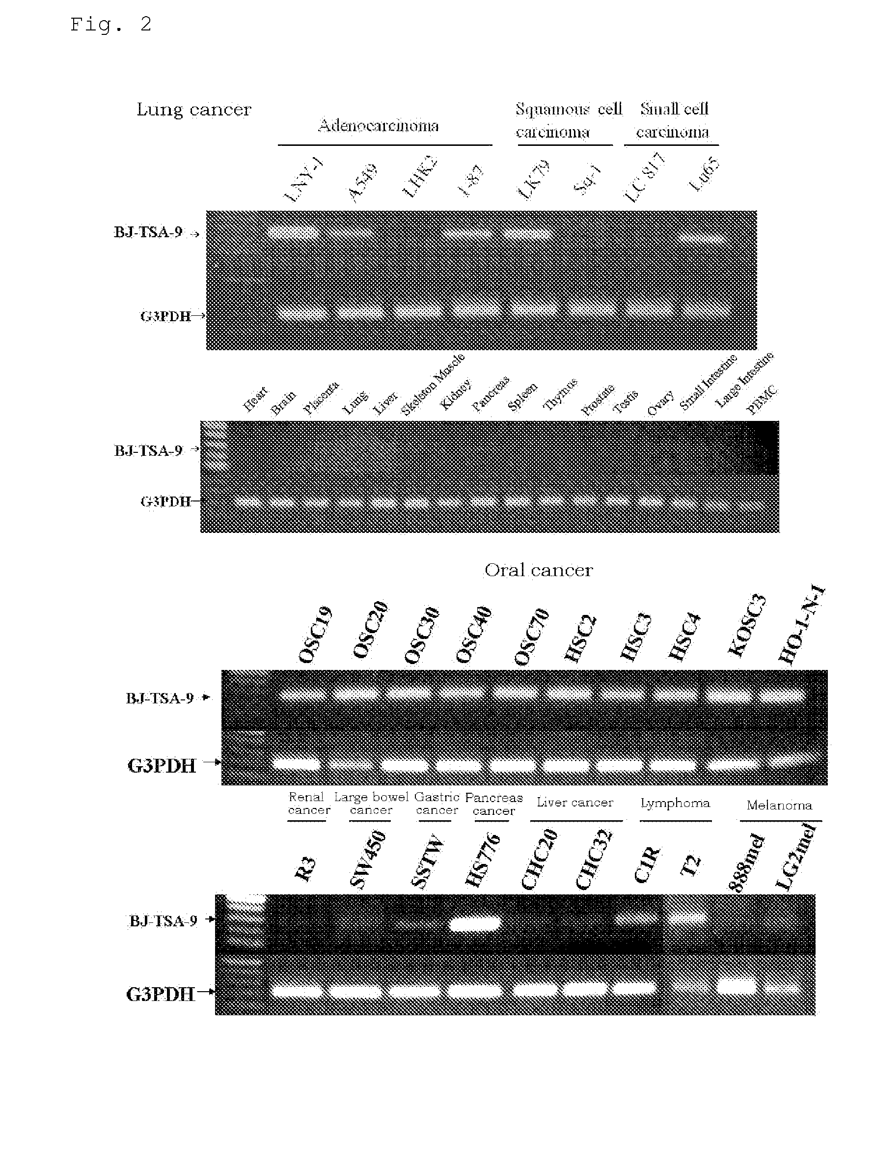 Novel tumor antigen peptides