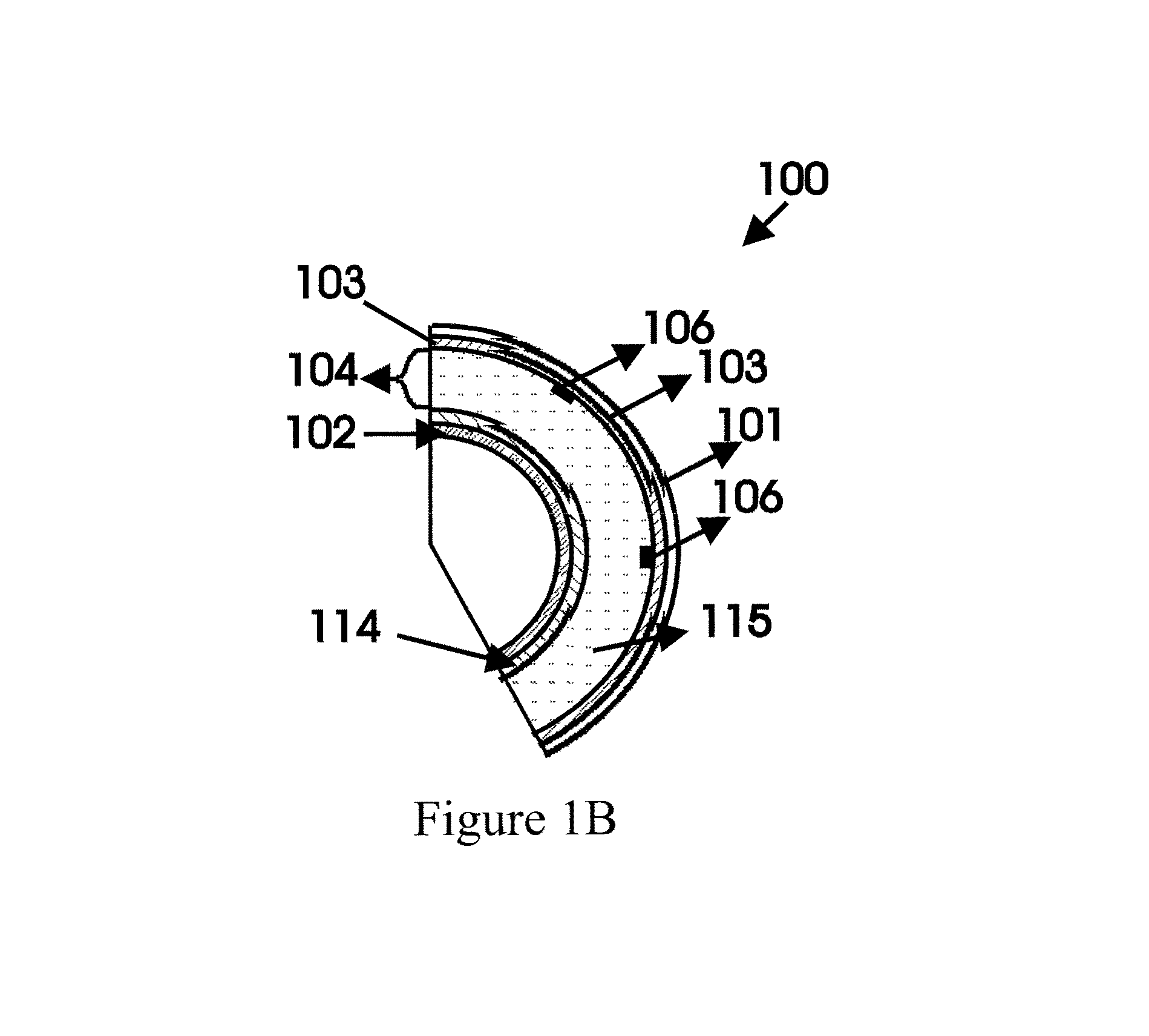 Mode tailored spherical laser