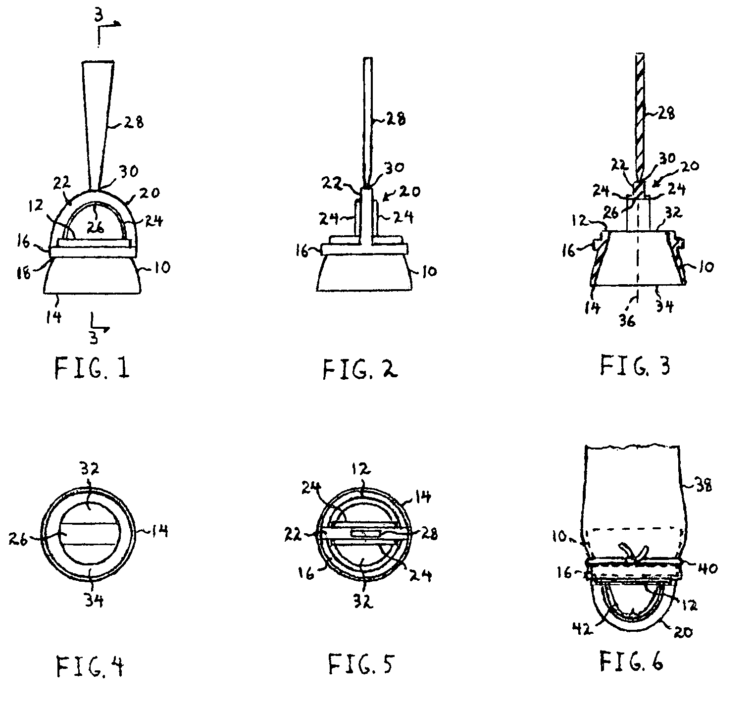 Circumcision device