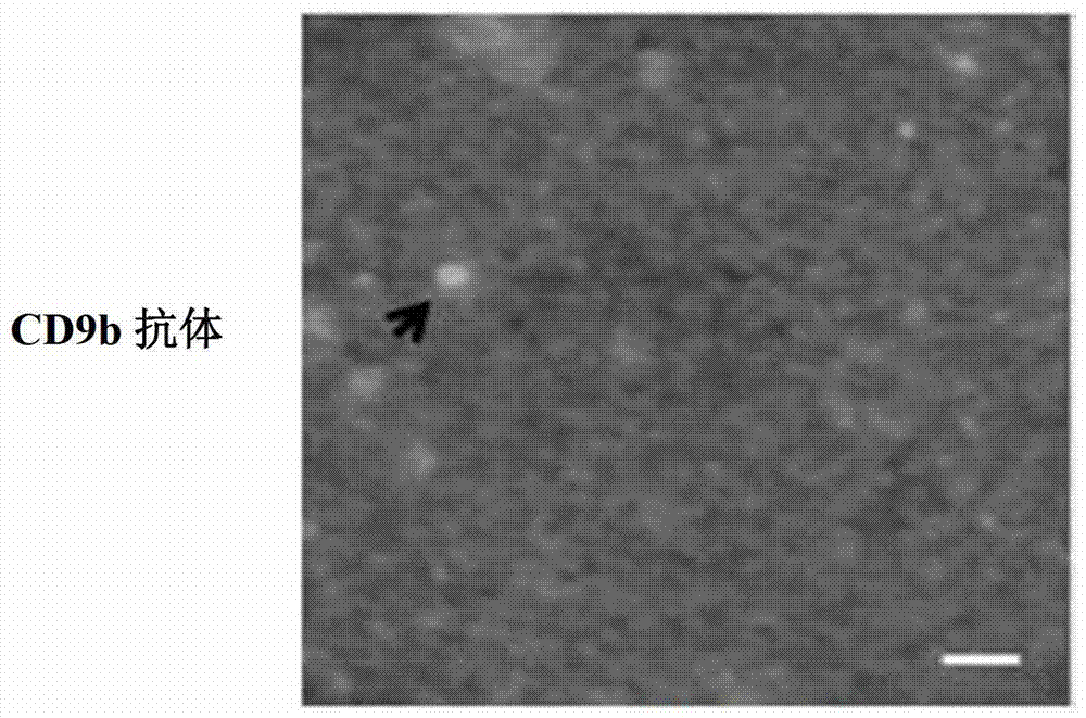 A method for detecting exocysts in liquid samples