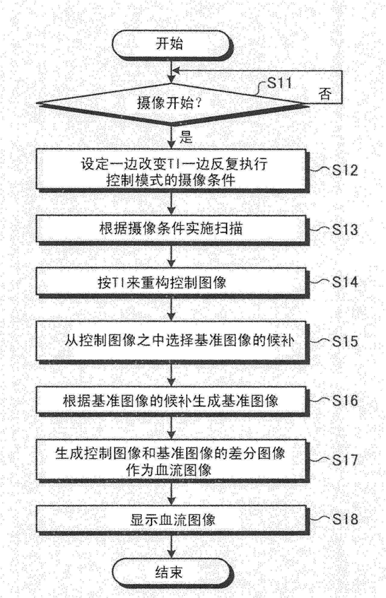 Magnetic resonance imaging apparatus