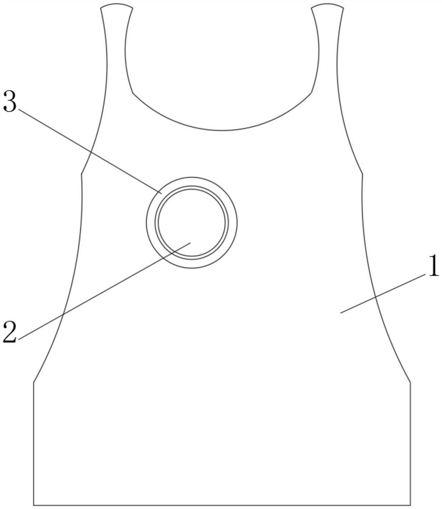 Implantable medical detection equipment and processing method