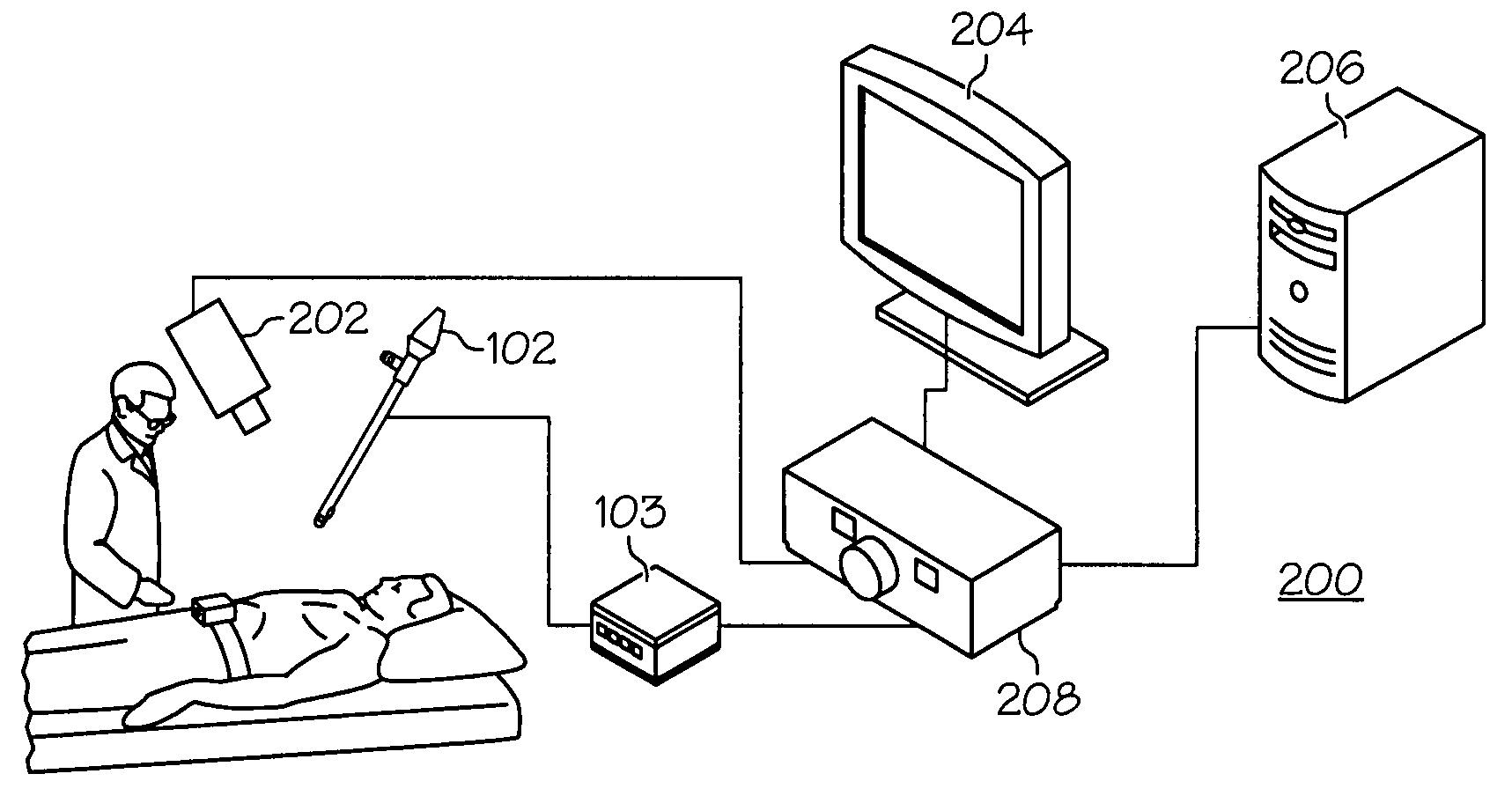 Combined SBI and conventional image processor