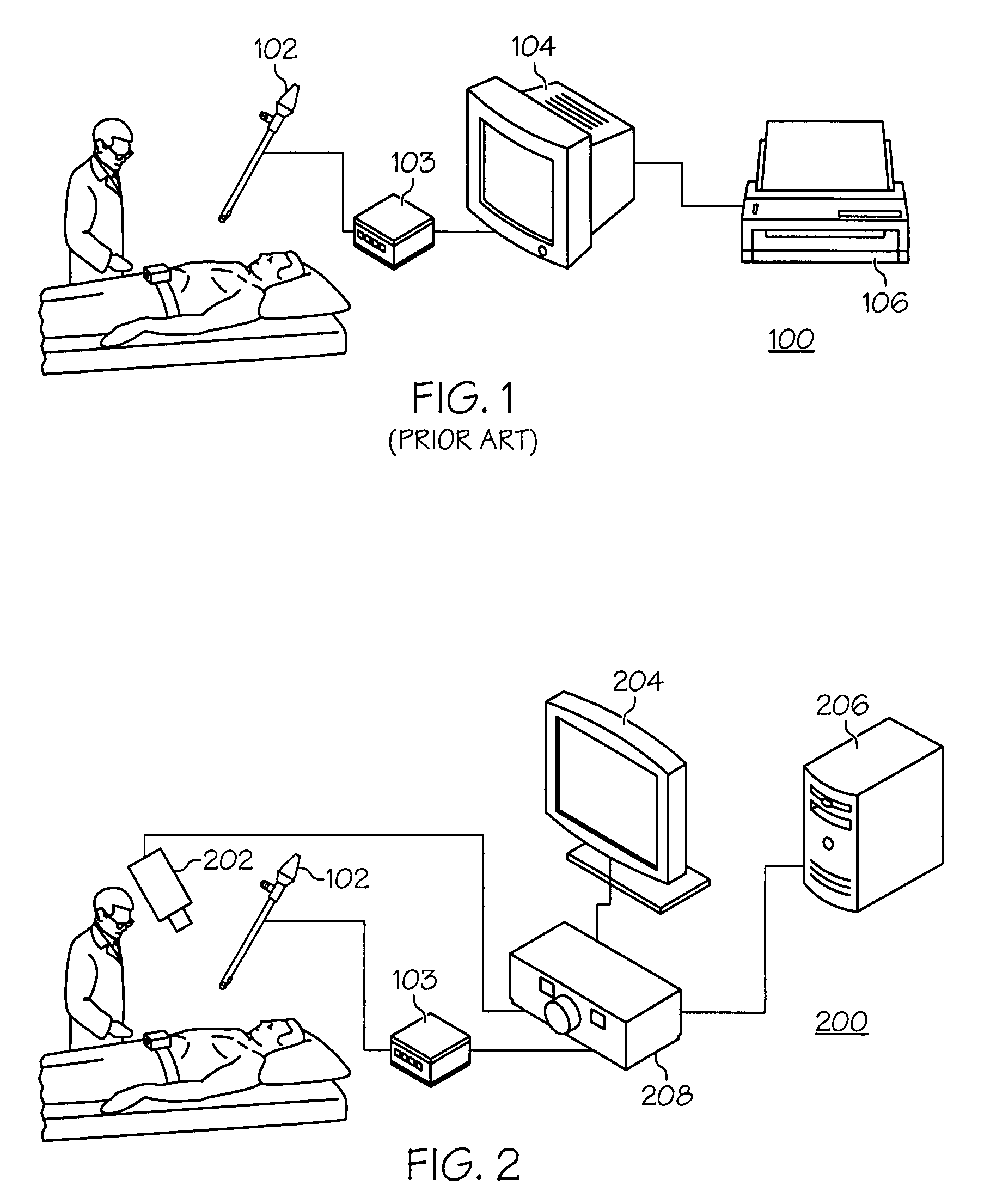 Combined SBI and conventional image processor