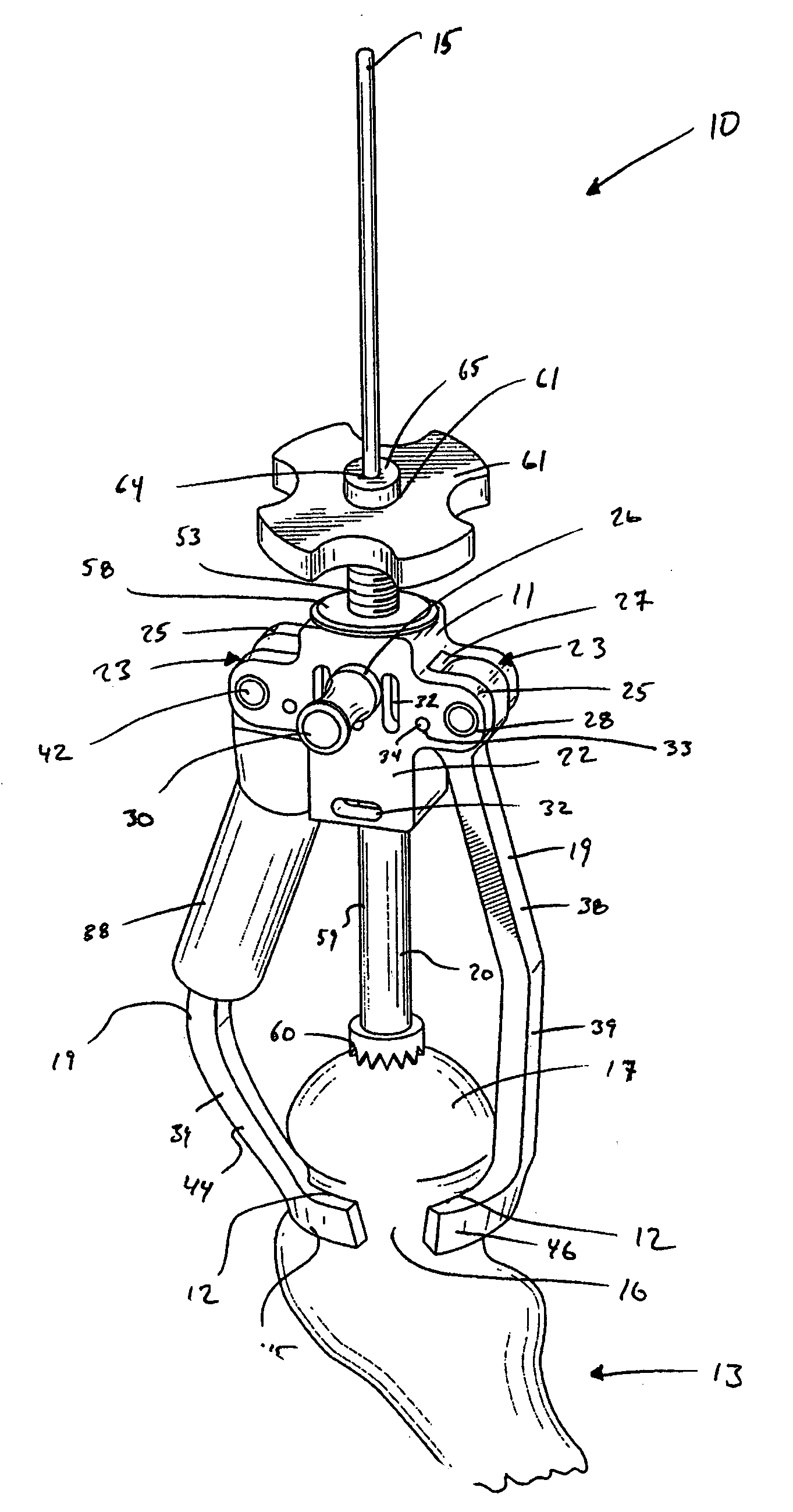 Guide clamp for guiding placement of a guide wire in a femur