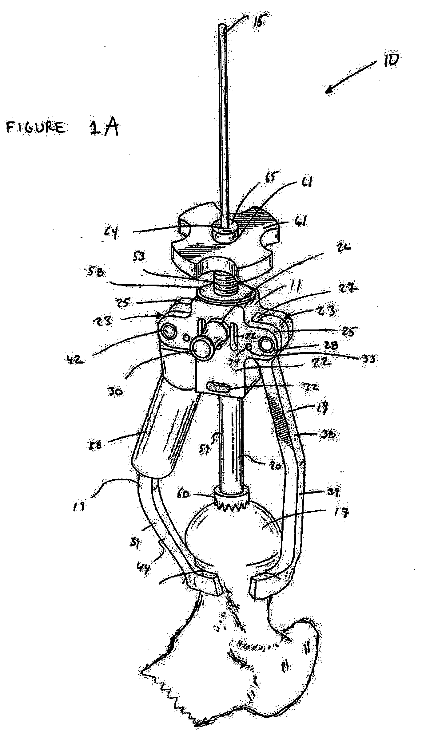 Guide clamp for guiding placement of a guide wire in a femur