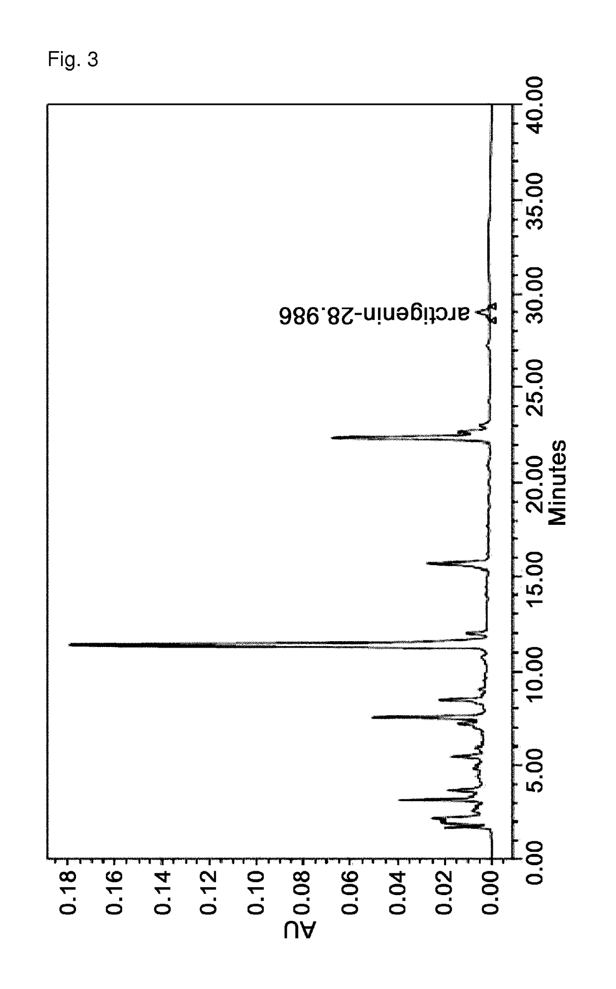Pharmaceutical composition for preventing or treating inflammatory diseases comprising trachelospermi caulis extract and paeonia suffruticosa andrews extract, and method for preparing the same