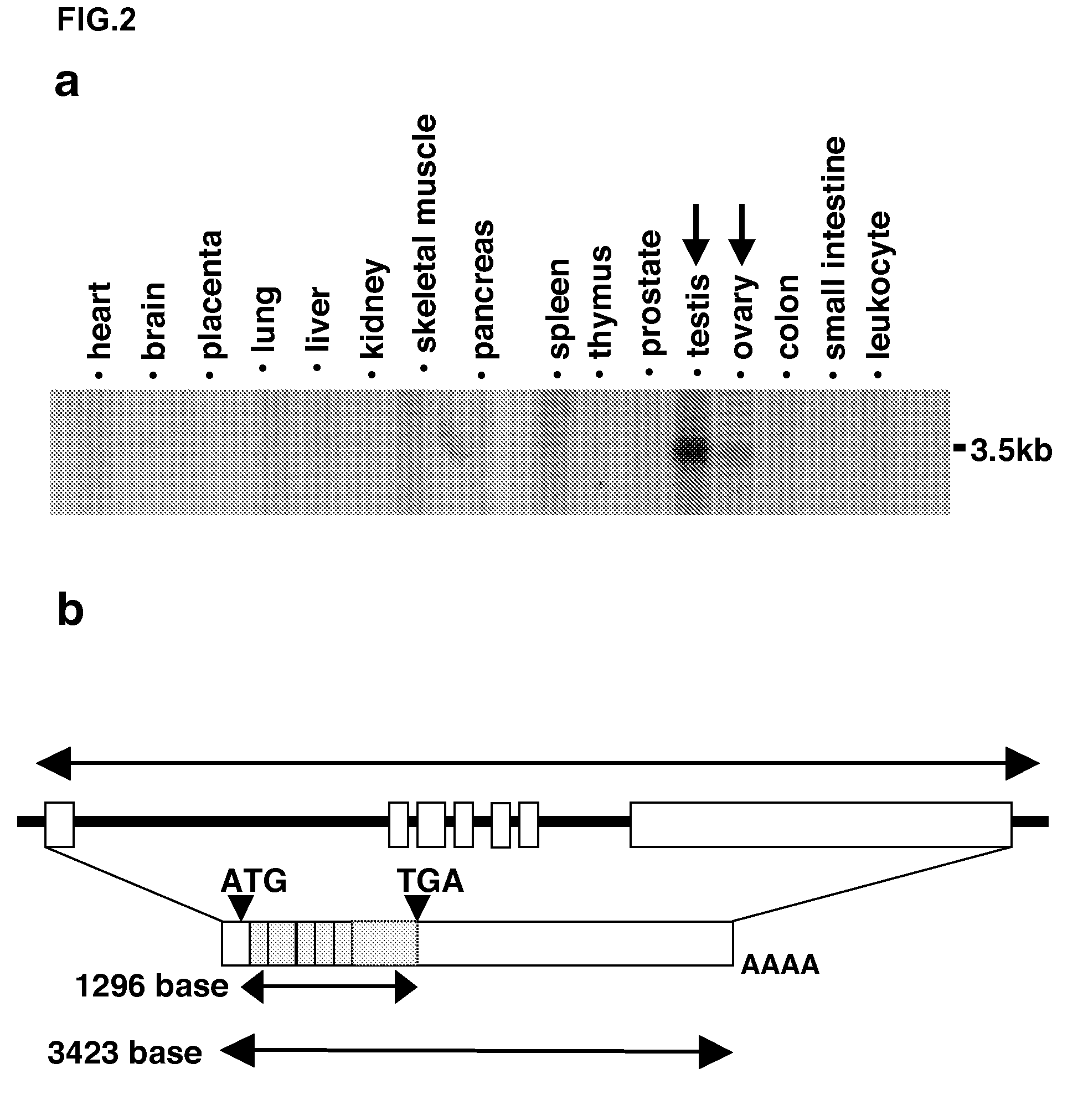 Genes and polypeptides relating to human colon cancers