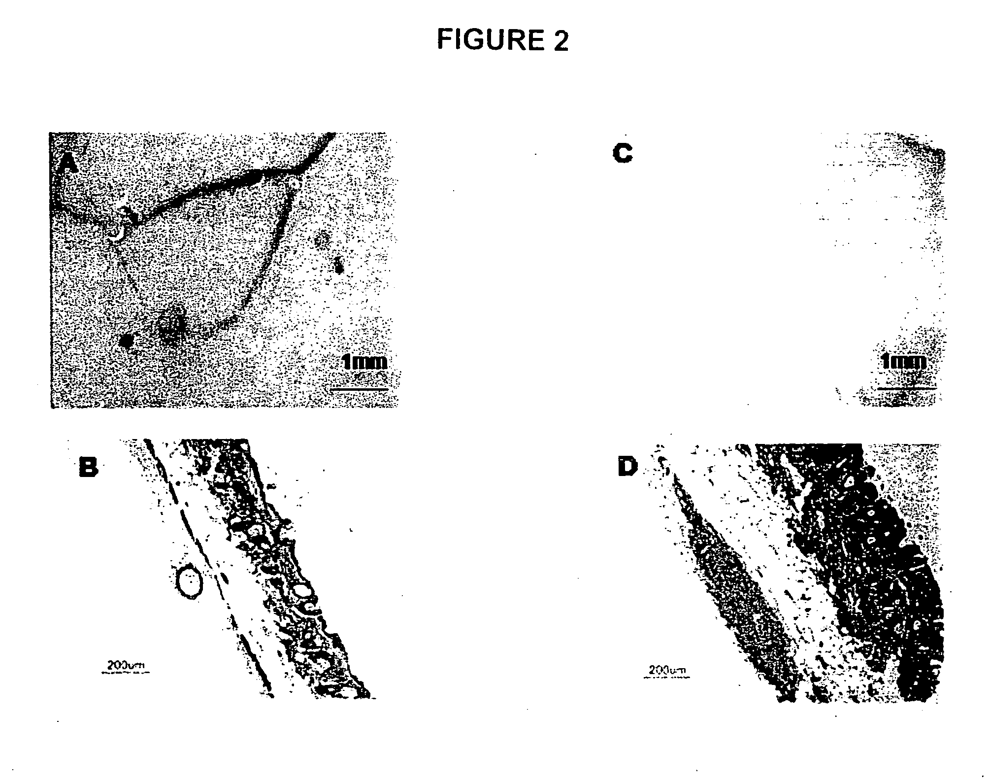 Organogenesis from dissociated cells