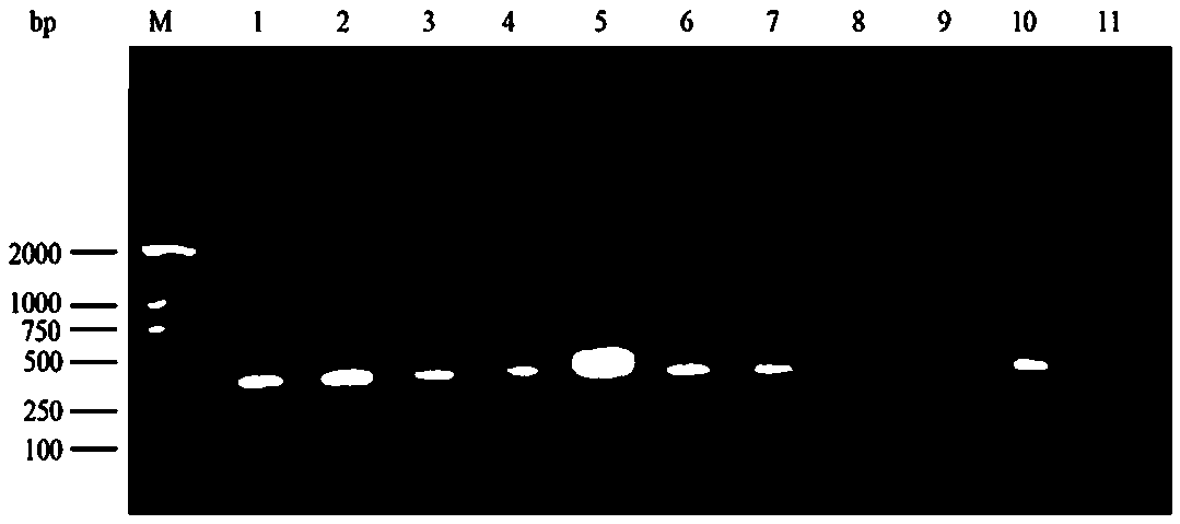 Detection method of coxsackievirus A10 in mixed infection of hand-foot-mouth disease