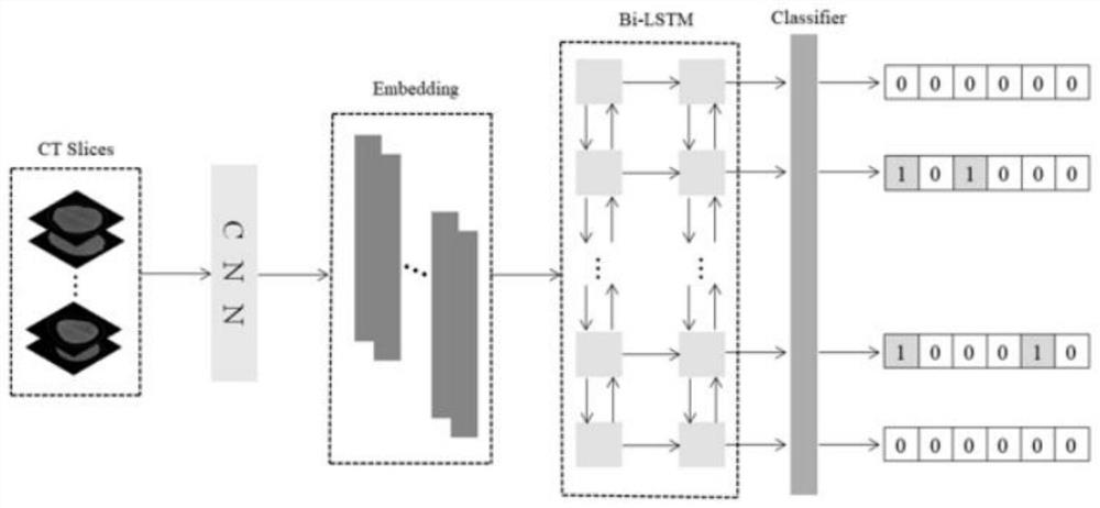 Intracranial hemorrhage sub-type classification algorithm applied to CT image based on bilinear pooling