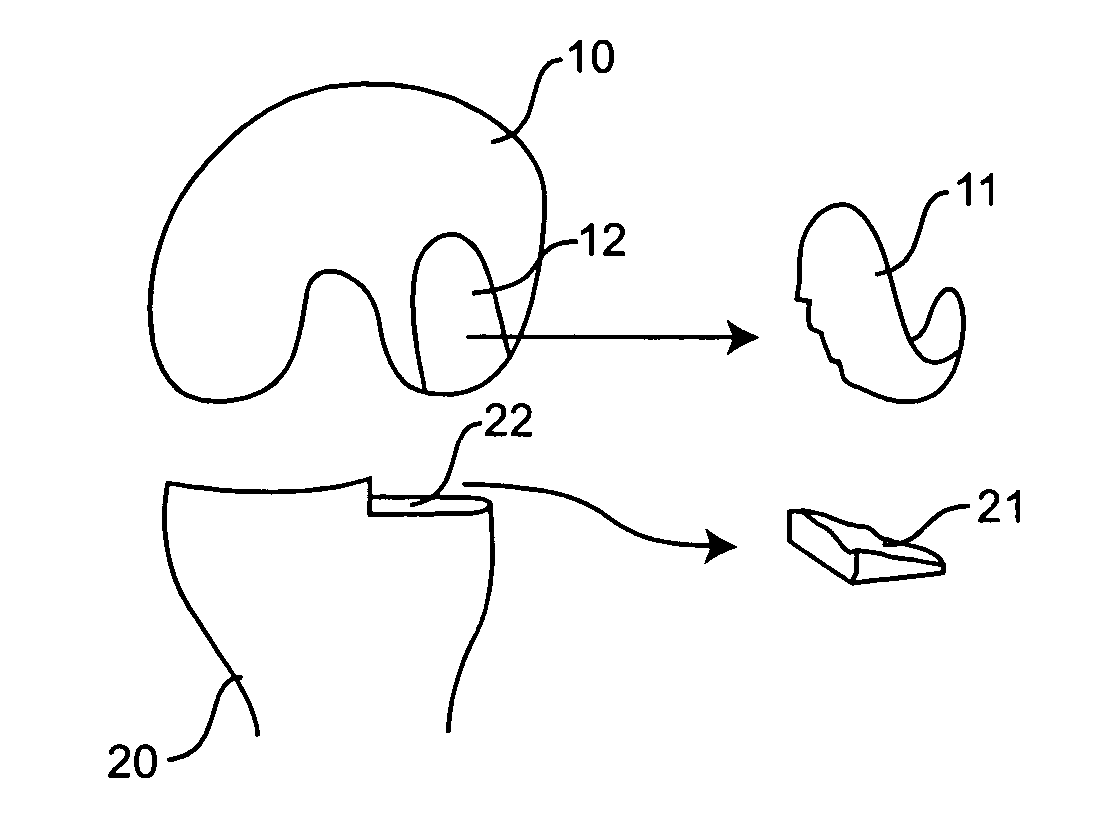 Bone mill and template