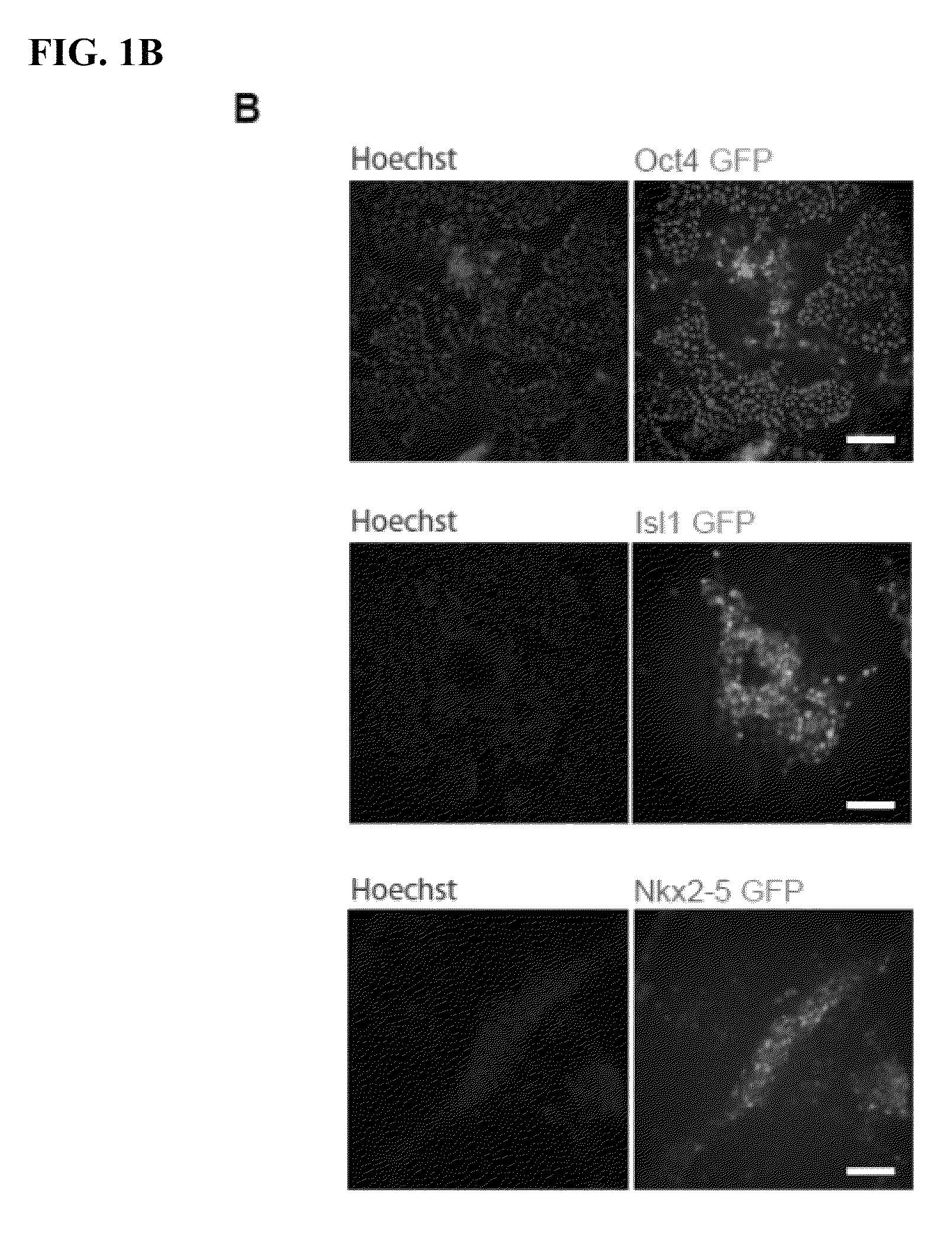 Generation of cardiomyocytes from human pluripotent stem cells