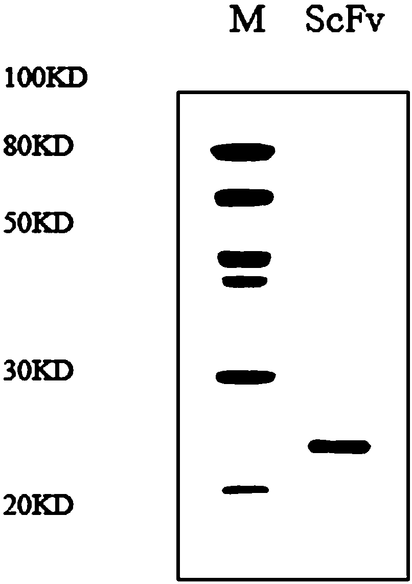 Single-chain antibody of human source anti-alexin C3d molecules and application thereof