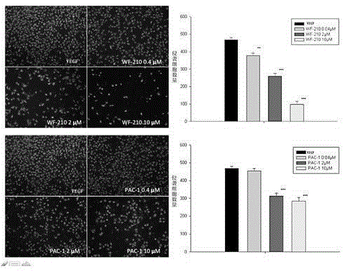 Use of oxadiazolylpiperazine compound in the preparation of anti-angiogenic drugs