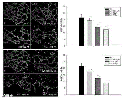 Use of oxadiazolylpiperazine compound in the preparation of anti-angiogenic drugs