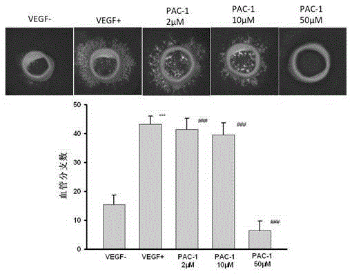 Use of oxadiazolylpiperazine compound in the preparation of anti-angiogenic drugs