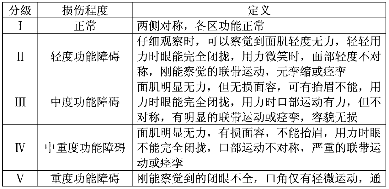 Traditional Chinese medicine composition treating facial neuritis, preparation method and application thereof