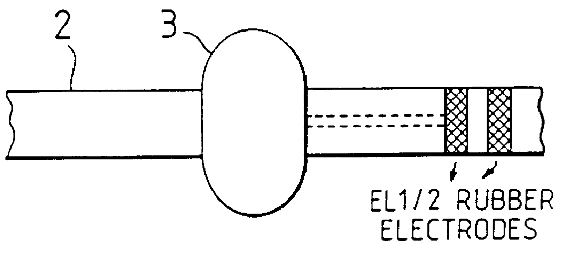 Biofeedback apparatus for use in therapy