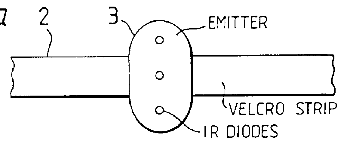 Biofeedback apparatus for use in therapy