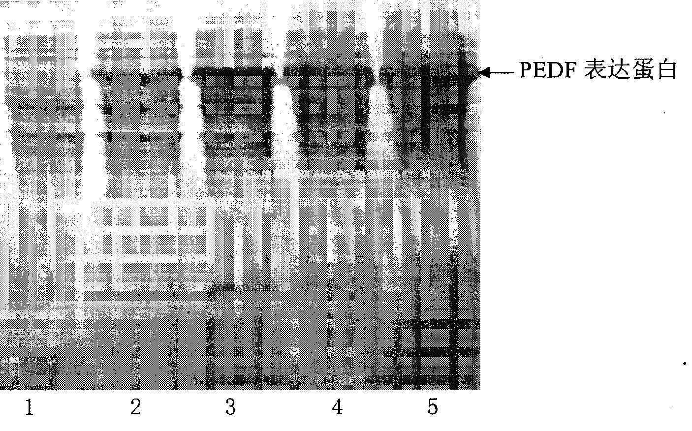 Compound containing pigment epidermal derived factors and preparation method and application thereof