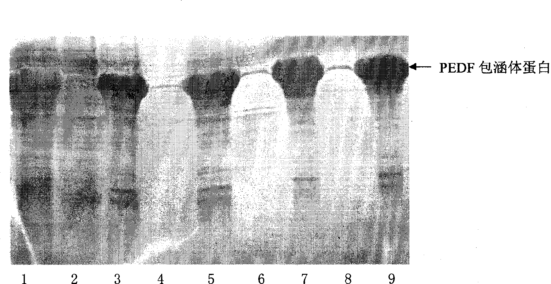 Compound containing pigment epidermal derived factors and preparation method and application thereof